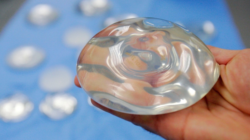 In this Dec. 11, 2001 file photo, a silicone gel breast implant is shown at a manufacturing facility in Irving, Texas. (AP Photo/Donna McWilliam, file)