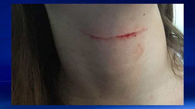 Okotoks teen attacked by man with knife