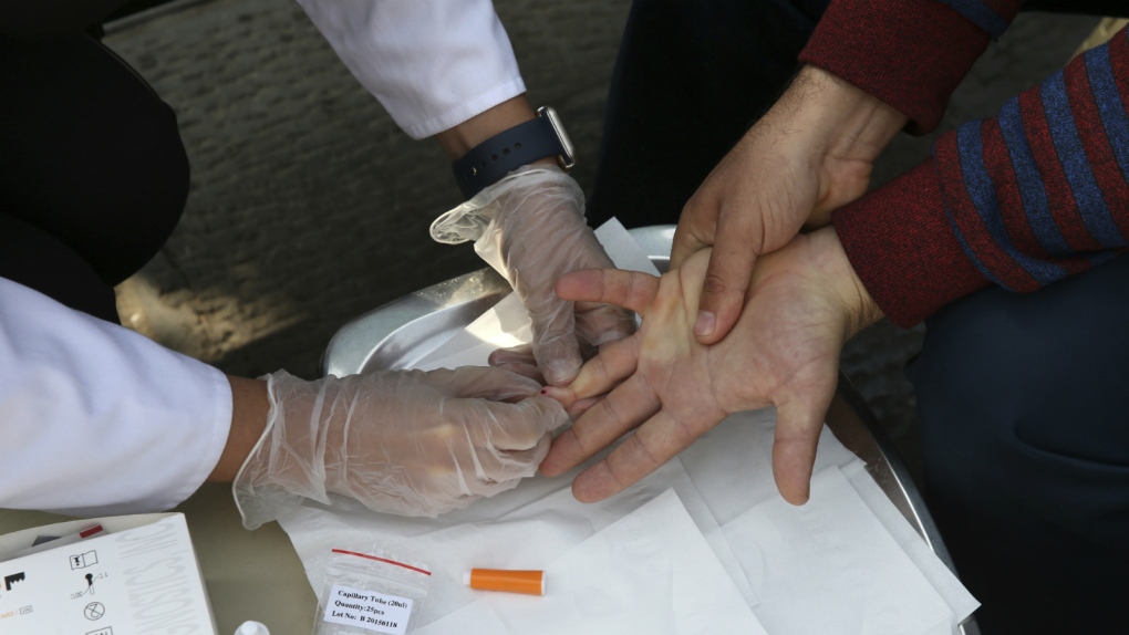 HIV rates rising in Iran
