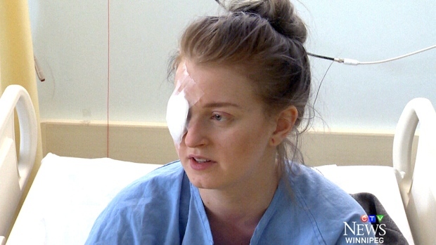 woman regains sight after suck punch attack