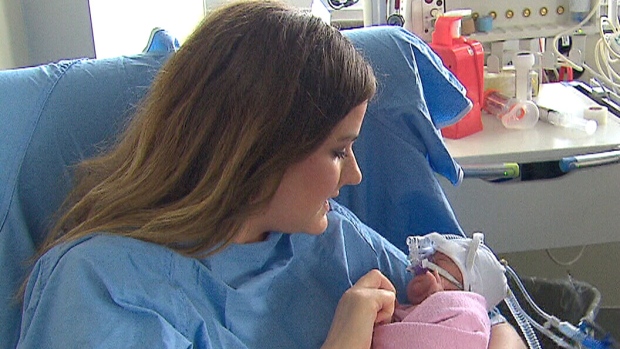 Preemie babies have better outcomes when parents are involved in ICU care: study 