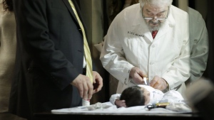 A campaign to ban circumcision for infants and children has taken hold in Iceland and Denmark but is far too radical a notion for Canada to consider, say observers here. Abraham Romi Cohn, right, examines Yosef Sananas before performing his bris, or ritual circumcision, in New York on Feb. 11, 2015. THE CANADIAN PRESS/AP-Seth Wenig