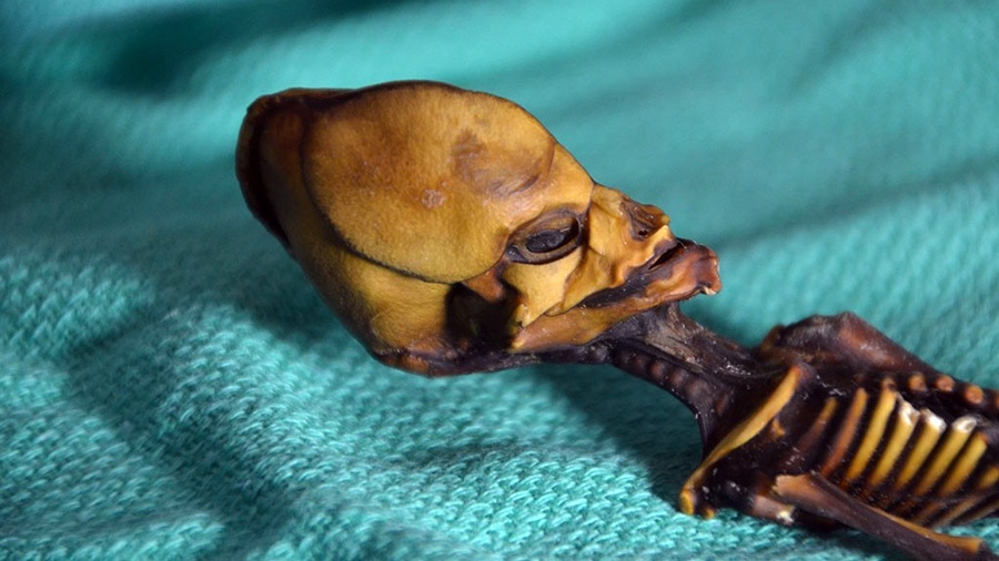 The deformed skull of the mummy named Ata