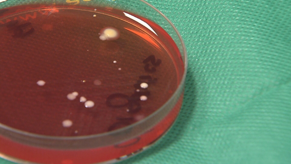 E. coli outbreak