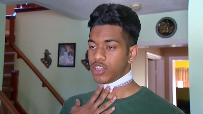 One of two 15-year-old victims of a seemingly random slashing in Scarborough tells CTV News Toronto that they noticed the suspect following them before they were ambushed. 