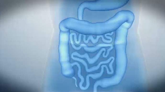 Study on colorectal cancer