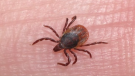 Biologist Andrew Hebda says Nova Scotia has 14 kinds of ticks, including the black-legged tick, which is most commonly known to transmit Lyme disease.