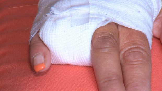 Woman Has Finger Ripped Off At West Edmonton Mall Waterslide Ctv News