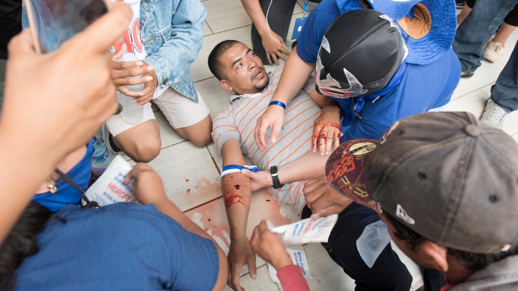 A wounded demonstrator in Managua, Nicaragua