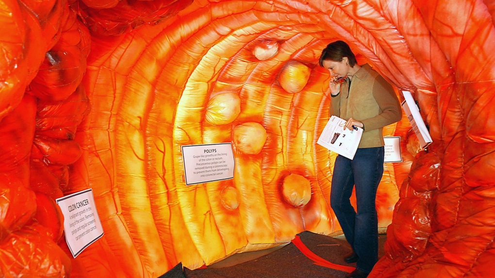 An inflatable replica of a human colon.