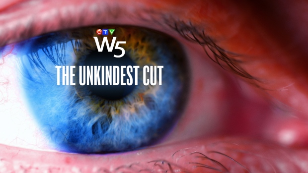 W5: The Unkindest Cut