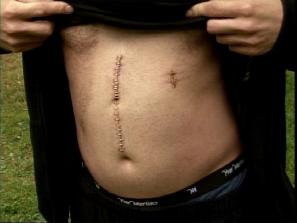 The victim of a Surrey, B.C., samurai sword attack says the incident was unprovoked. July 9, 2009.