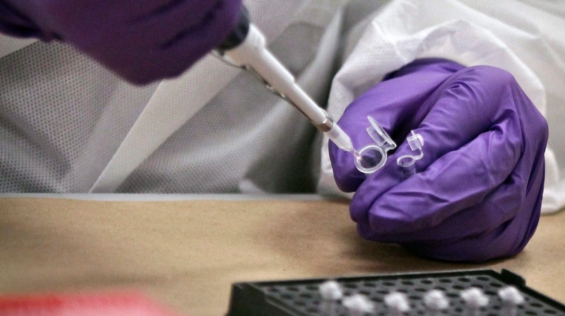 In this April 15, 2014, file photo, a criminalist trainee prepare sample bone fragments for DNA testing at the training lab in the Office of Chief Medical Examiner in New York. (AP Photo/Bebeto Matthews, File)