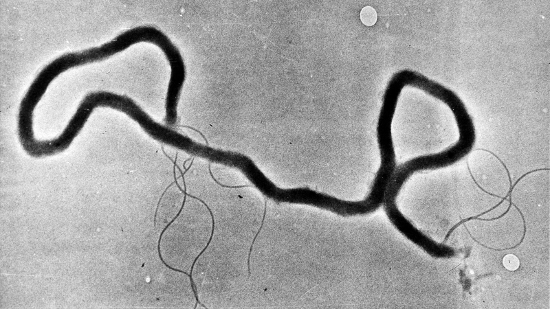 In this May 23, 1944 file photo, the organism treponema pallidum, which causes syphilis, is seen through an electron microscope. (AP Photo)