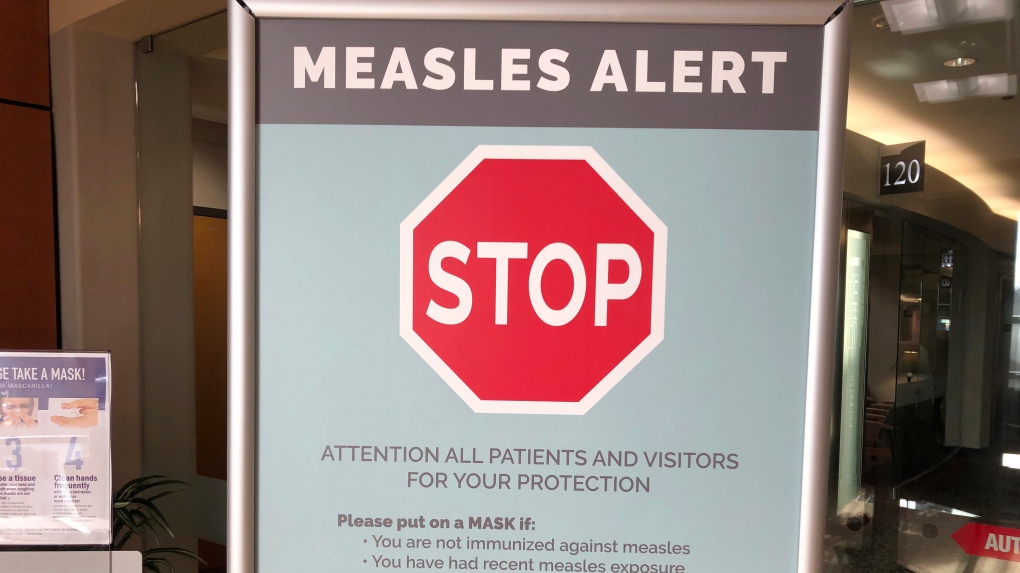 Measles outbreak warning