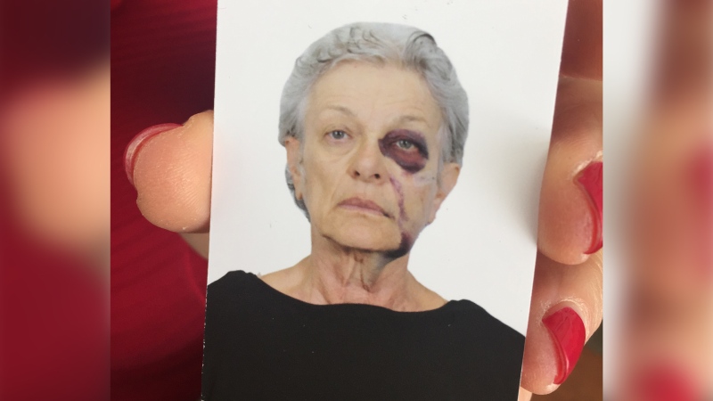 Back home in Sarnia, Ont., Marianne Clift holds a photo of herself showing her injuries after her attack in Mexico. (Sacha Long / CTV London)