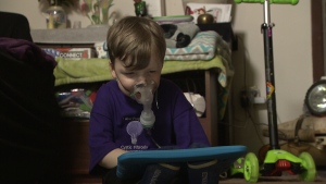 Four-year-old Liam struggles to breath on a daily basis due to Cystic Fibrosis. 