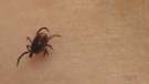 A Queen's University Master's candidate is looking for submissions to a study that aims to better understand ticks and Lyme disease.