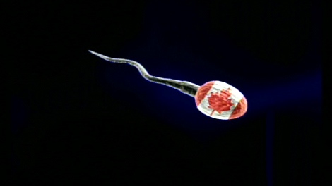 Couples face shortage of Canadian sperm 