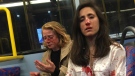 Melania Geymonat said she and her girlfriend were attacked on a bus in London by a group of men. (Melania Ps / Facebook) 