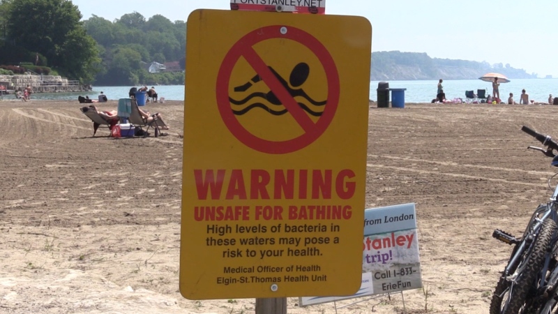 A sign warns of high E. coli levels at a beach in Port Stanley, Ont. on Friday, June 28, 2019. (Celine Moreau / CTV London)