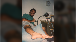 Jeff Weakley discovered a tooth lodged in his foot 24 years after he was bitten by a shark. (Jeff Weakley) 
