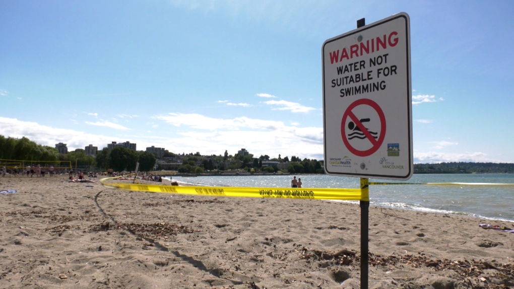 Kits Beach closed to swimming