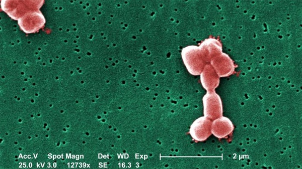 Clusters of aerobic Gram-negative, non-motile Acinetobacter baumannii bacteria are seen under a magnification of 12,739x. (CDC)