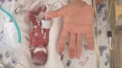 Jaden Morrow was born four months early weighing just 13 ounces, or 0.8 pounds. (Source: GoFundMe)
