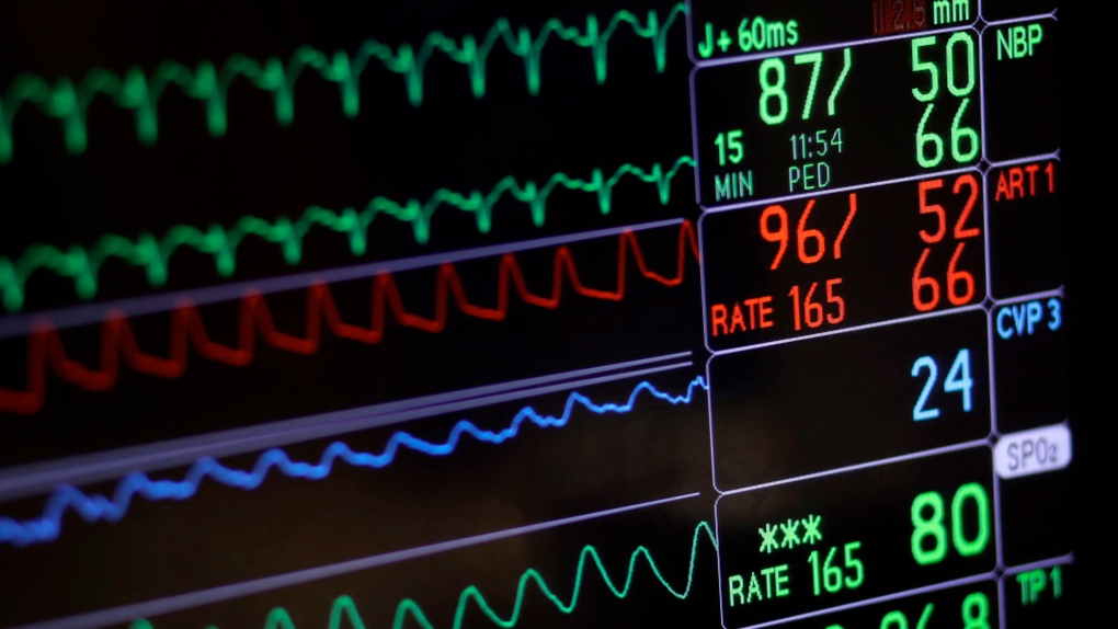A screen displays a patient's vital signs