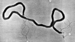 The organism treponema pallidum, which causes syphilis, is seen through an electron microscope in this May 23, 1944 file photo. (The Associated Press)