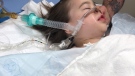 Five-year-old Autumn Ferguson's lungs collapsed during dental surgery. 