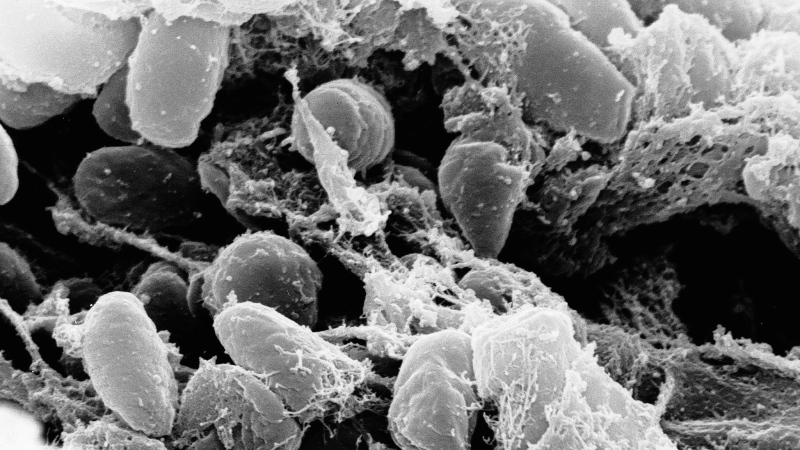  Black plague re-emerges in China after man eats w