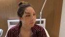 Ottawa woman Lexie York recovers in Cancun hospital after a vicious attack. 