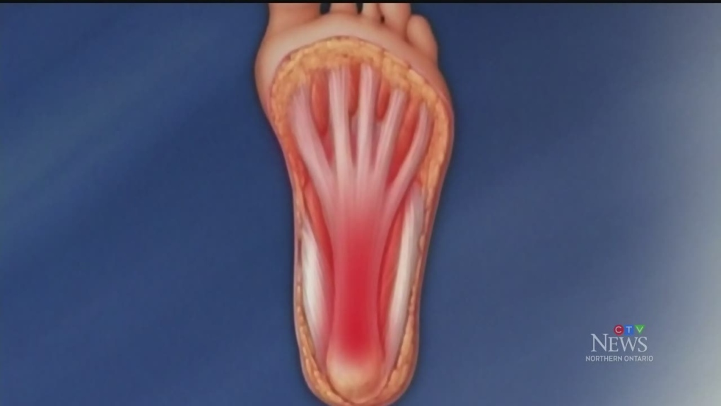 Talking to a foot health expert about heel pain