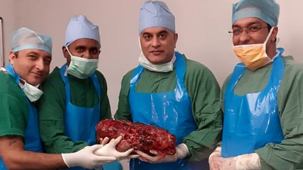 India's heaviest kidney