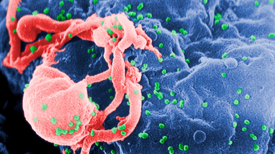 Virus HIV-1 pada permukaan sel