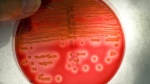 In this Nov. 7, 2008 file photo, Methicillin-resistant Staphylococcus aureus colonies from a Seattle hospital patient grow in a blood agar plate at a local lab in Seattle. (Mike Siegel/The Seattle Times via AP)