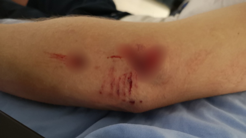 Images of the mail carrier's wounds have been censored due to their graphic nature: (CUPW Victoria Local 850)