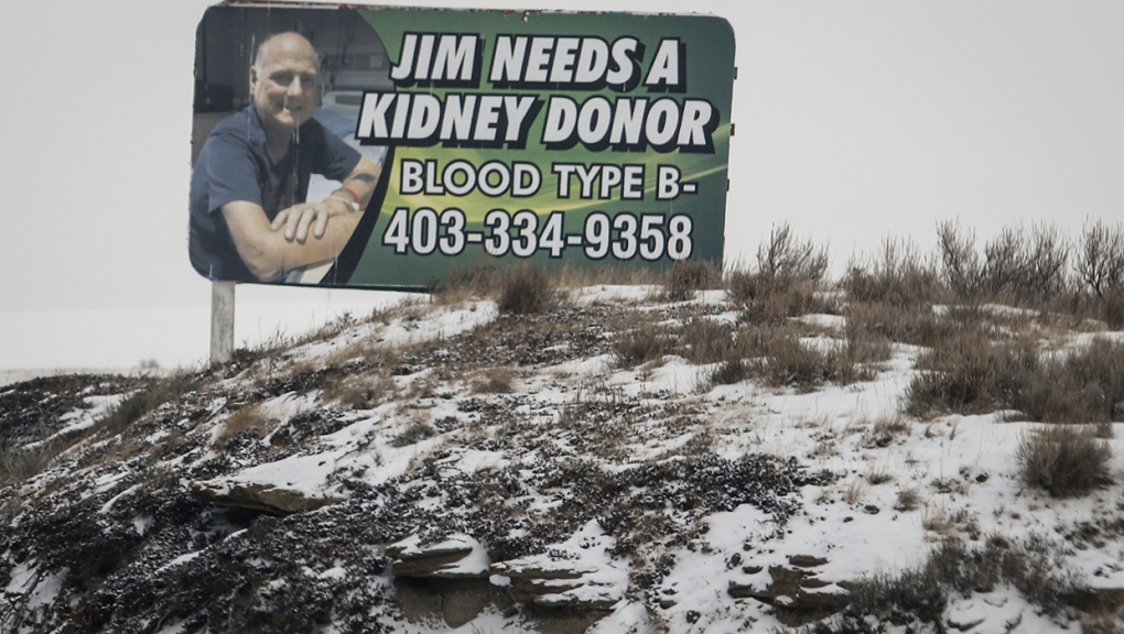Jim Lomond, kidney, billboard, Drumheller