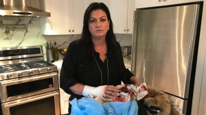 Barrie realtor Carrie Stiles says she was viciously attacked by a dog injuring her hand on Sun., Feb. 16, 2020. (Aileen Doyle/CTV News)