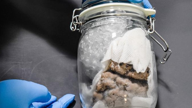 Human brain specimen seized at Bluewater Bridge