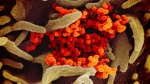 FILE - This undated electron microscope image made available by the U.S. National Institutes of Health in February 2020 shows the Novel Coronavirus SARS-CoV-2, orange, emerging from the surface of cells, green, cultured in the lab. (NIAID-RML via AP)