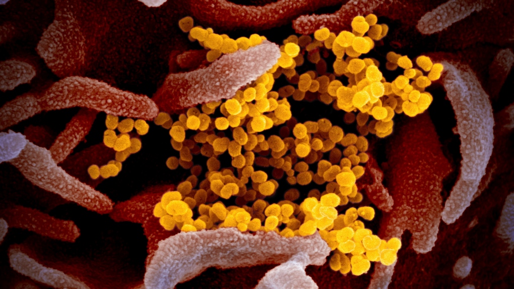 coronavirus