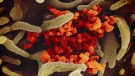 This undated electron microscope image made available by the U.S. National Institutes of Health in February 2020 shows the Novel Coronavirus SARS-CoV-2, orange, emerging from the surface of cells, green, cultured in the lab. The Alberta government says it is now dealing with a second presumptive case of the novel coronavirus and is ramping up testing protocols. THE CANADIAN PRESS/HO - NIAID-RML via AP