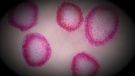 Microscopic view of coronavirus. (CTV News)