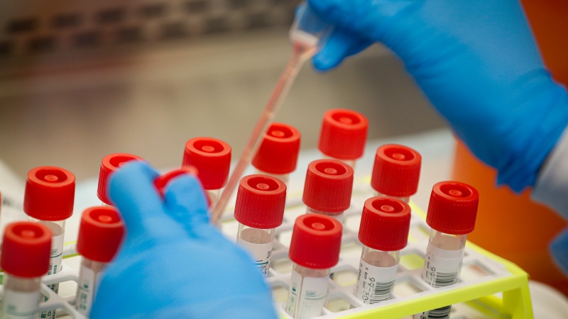 A technician prepares COVID-19 coronavirus patient samples for testing at a laboratory in New York's Long Island on Wednesday, March 11, 2020. (AP / John Minchillo)
