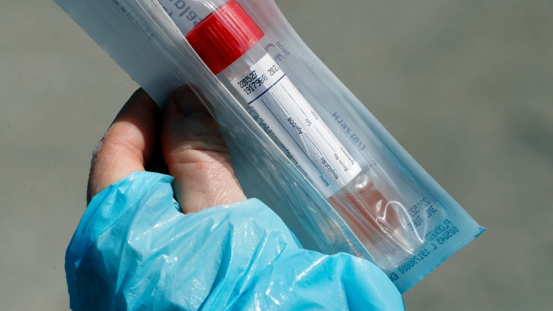 A healthcare worker shows a package with items used for testing people for COVID-19. (AP Photo/Carlos Osorio)