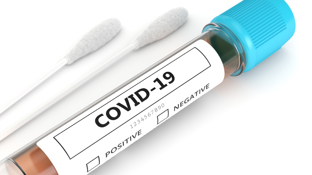 COVID-19 test generic