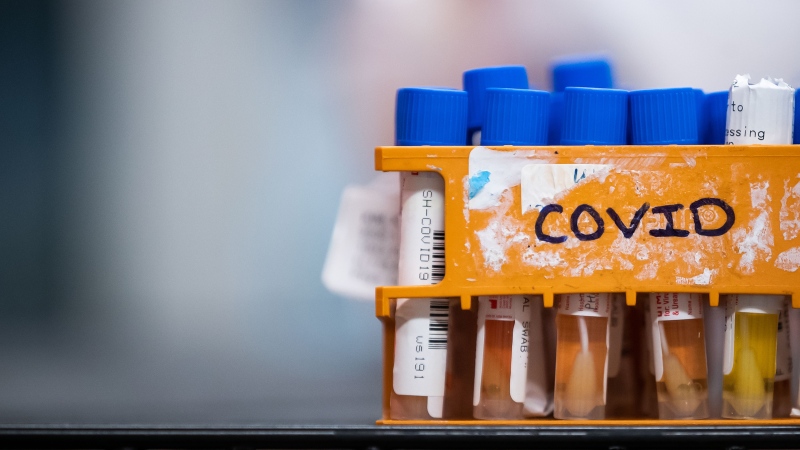 Specimens to be tested for COVID-19 are seen at LifeLabs after being logged upon receipt at the company’s lab, in Surrey, B.C., March 26, 2020. THE CANADIAN PRESS/Darryl Dyck